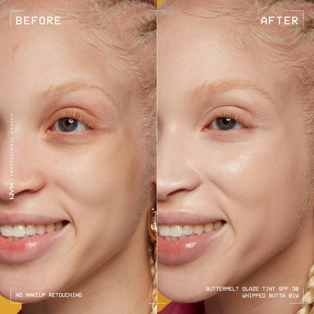 Yapısına Gore Fondoten Ceşitleri