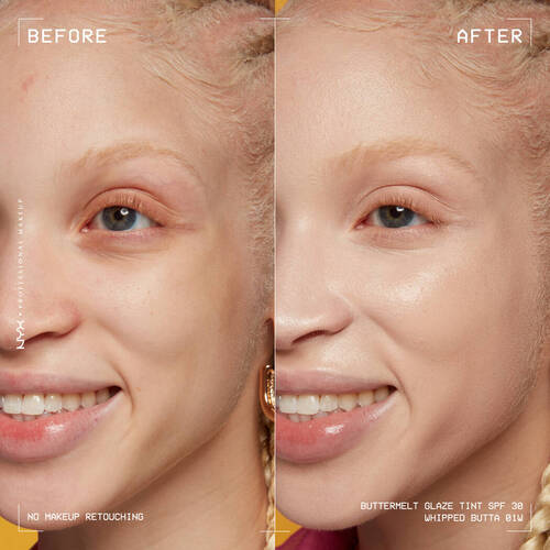 Yapısına Gore Fondoten Ceşitleri