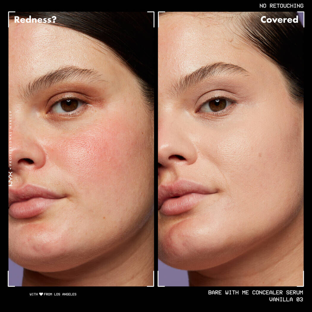 Kapatıcı ve Concealer Nedir?